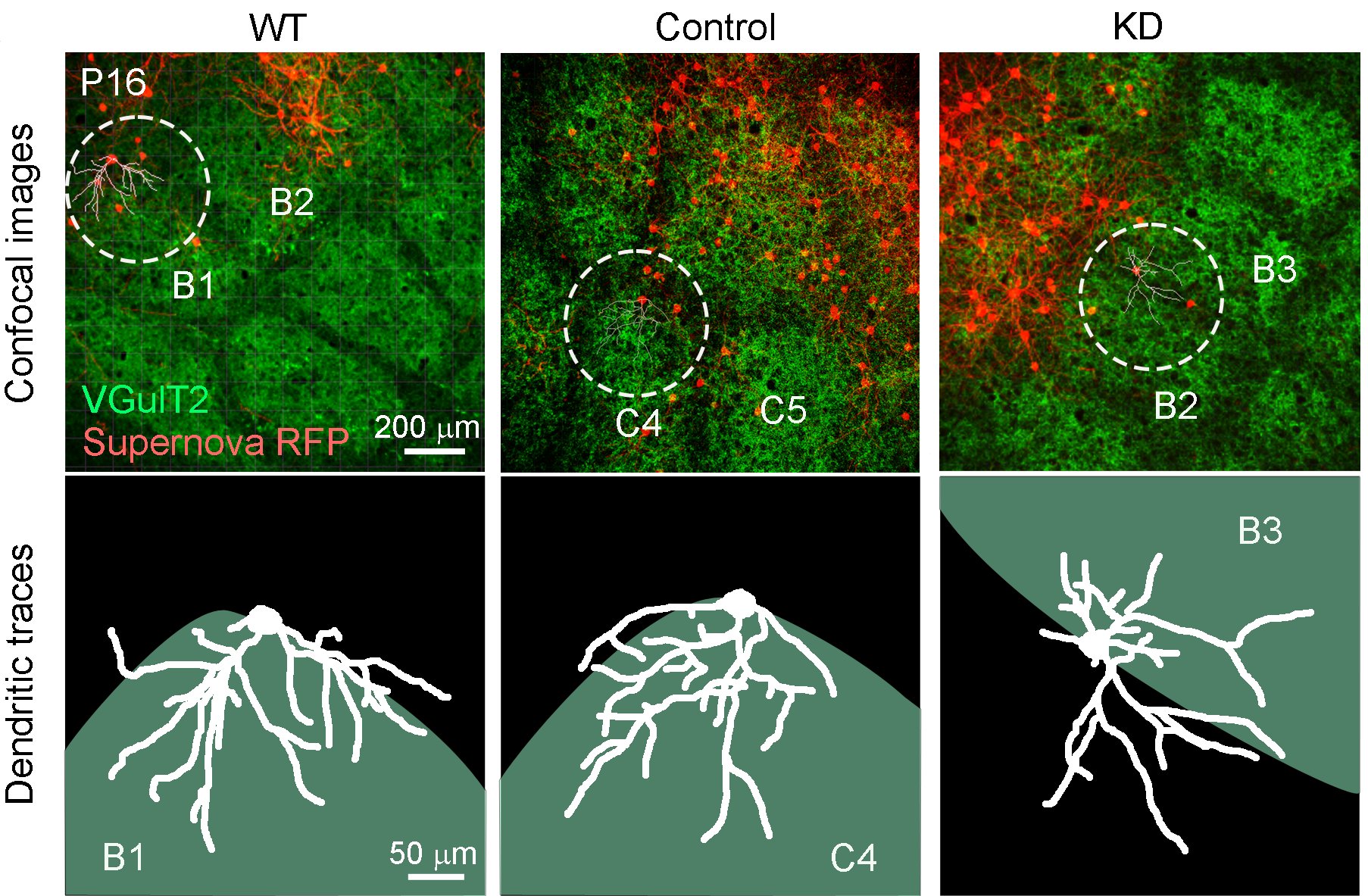 Publicationsras Gtpase Activating Proteins Control Neuronal Circuit